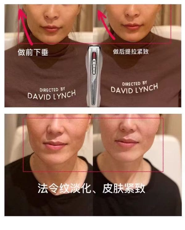 VC Dual Rejuvenation Capsule Essence Oil + Retinol Skin Shaping  Capsule Essence OIl - Image 24